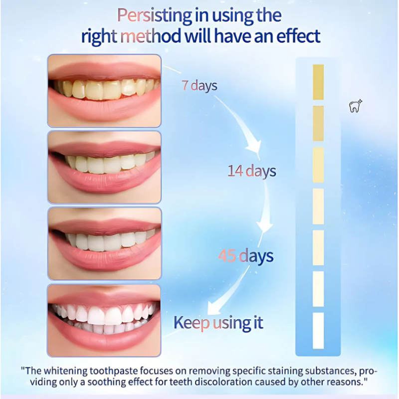 WhiteningToothpaste 1+1 GRATIS: Niacinamide Witmaking En Vlekverwijdering Tandpasta