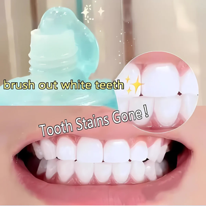 WhiteningToothpaste 1+1 GRATIS: Niacinamide Witmaking En Vlekverwijdering Tandpasta