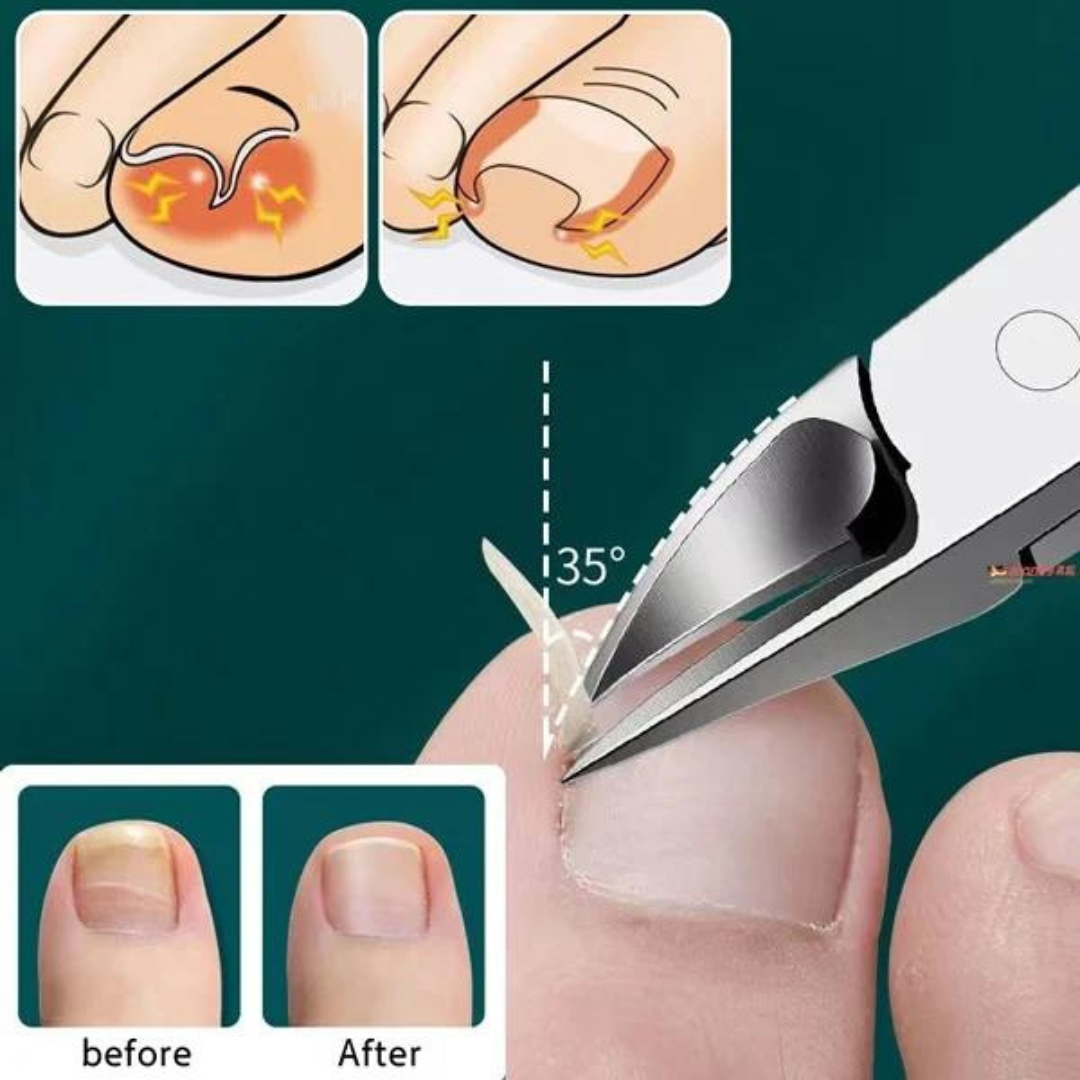 Globetrek° Nipper - Professionele Nagels en Nagelriemk Nipper